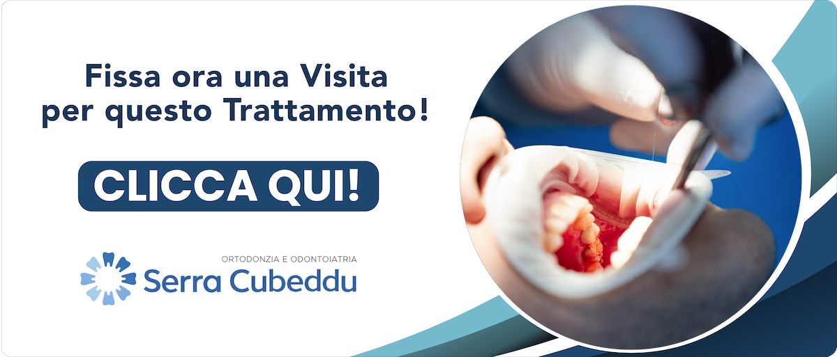 endodonzia Sassari