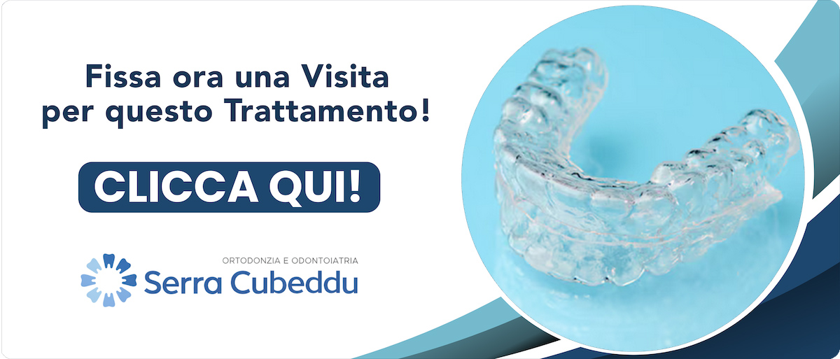 ortodonzia-invisalign Sassari