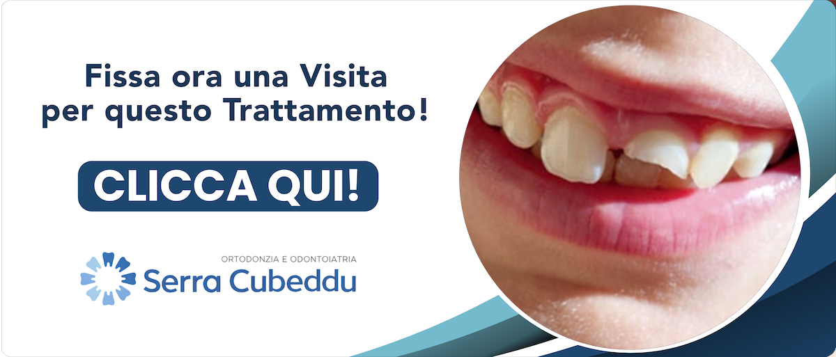 traumatologia-dentale Sassari